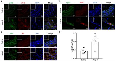 Inhibition of Peptidyl Arginine Deiminase 4-Dependent Neutrophil Extracellular Trap Formation Reduces Angiotensin II-Induced Abdominal Aortic Aneurysm Rupture in Mice